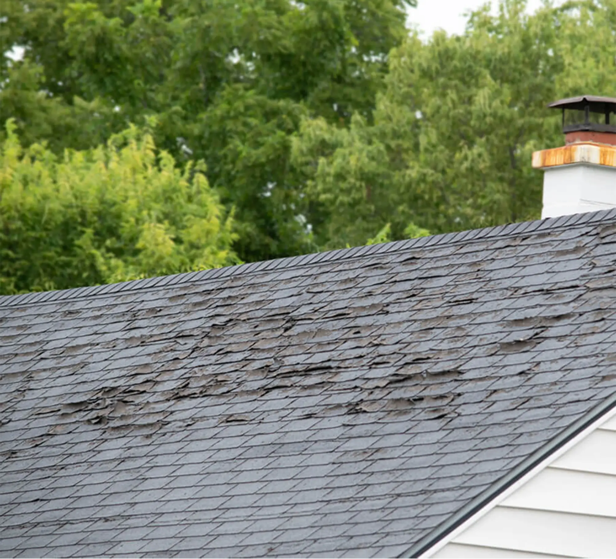 Shingles